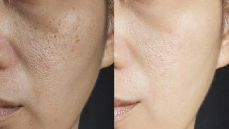Glutathione injections | Shaanxi Bloom Tech Glutathione injections | Shaanxi Bloom Tech